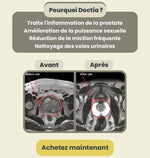 Charger l'image dans la galerie, A-Inhaleur Prostate au Venin d'Abeille | Retrouvez une érection en 3 minutes!
