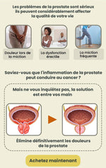 Charger l'image dans la galerie, A-Inhaleur Prostate au Venin d'Abeille | Retrouvez une érection en 3 minutes!
